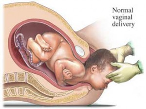 Deliveries Of Male Infants Mean More Complications