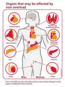 Help For Patients With Iron Overload
