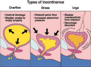 Hormone Replacement Worsens Incontinence