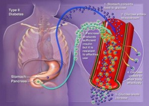 Pills For Diabetes Not Always Useful