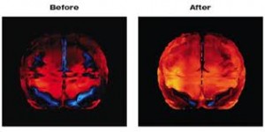 Look At The Brain To Avoid Missed Diagnoses and Treatment Failures