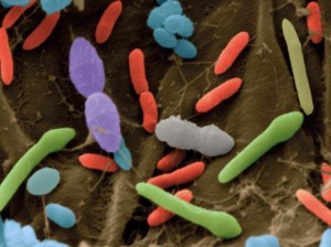 Changes Of Gut Bacteria Can Cause Heart Attacks
