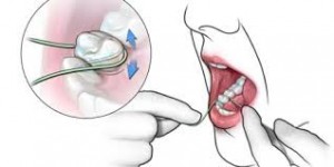 Flossing and Brushing Saves Your Heart