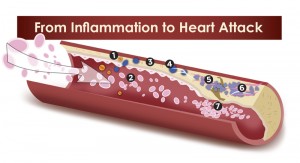 From Inflammation To Heart Attacks, Strokes And Arthritis