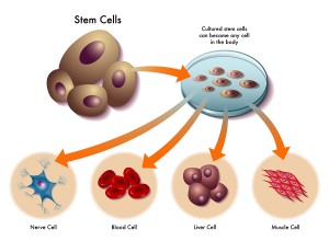 Prolotherapy And Stem Cell Therapy