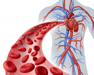 Seventeen Causes Of Blood Vessel Disease