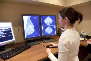 Less Chemotherapy For Breast Cancer Patients