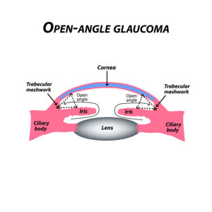 Fibrotic Eye Disease Responds to Nicotinamide (Vitamin B3)