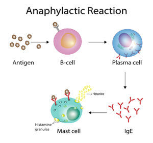 Mast Cell Activation Syndrome