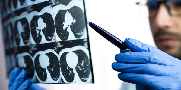 Lung Cancer Screening Program
