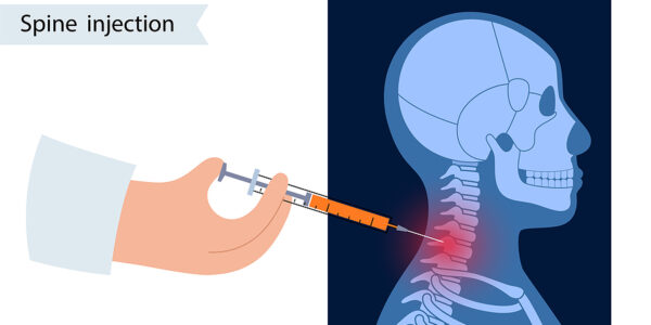 More Stem Cell Treatments of my lower Cervical and upper Thoracic Spine