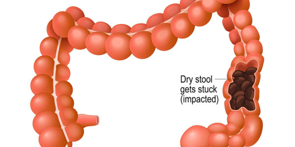 About your Bowel Movements