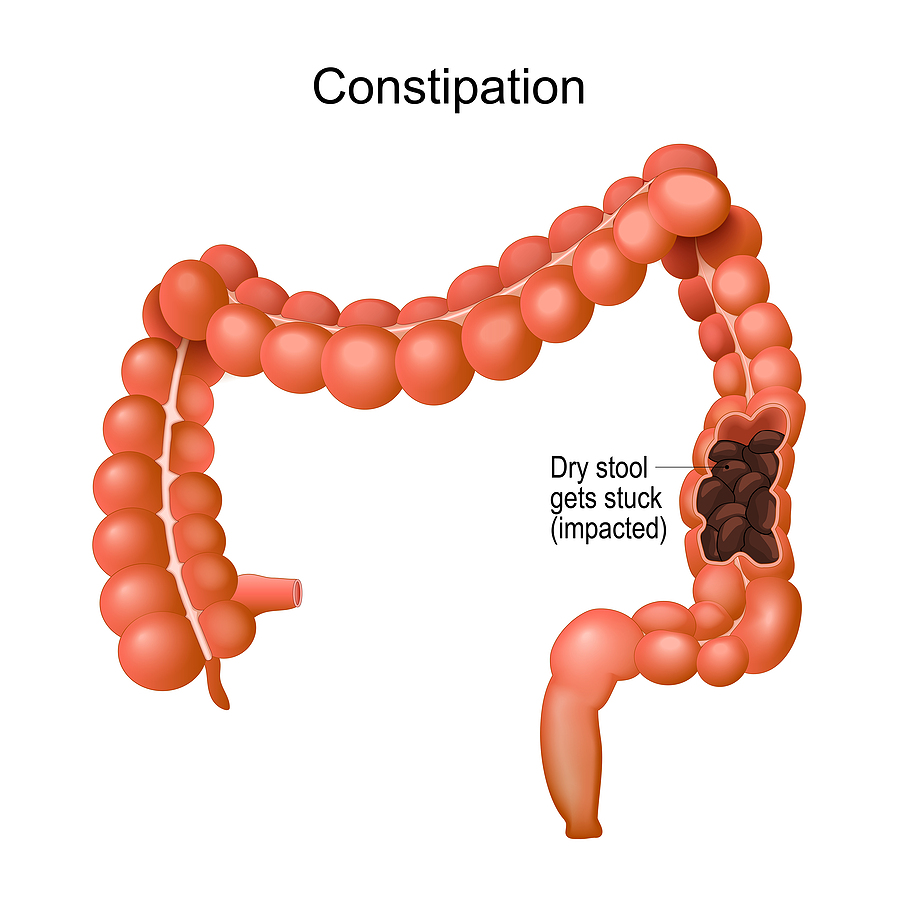 About your Bowel Movements - Medical Articles by Dr. Ray