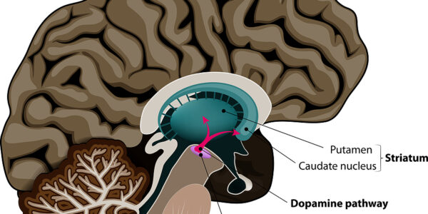 How the Immune System affects Parkinson’s Disease